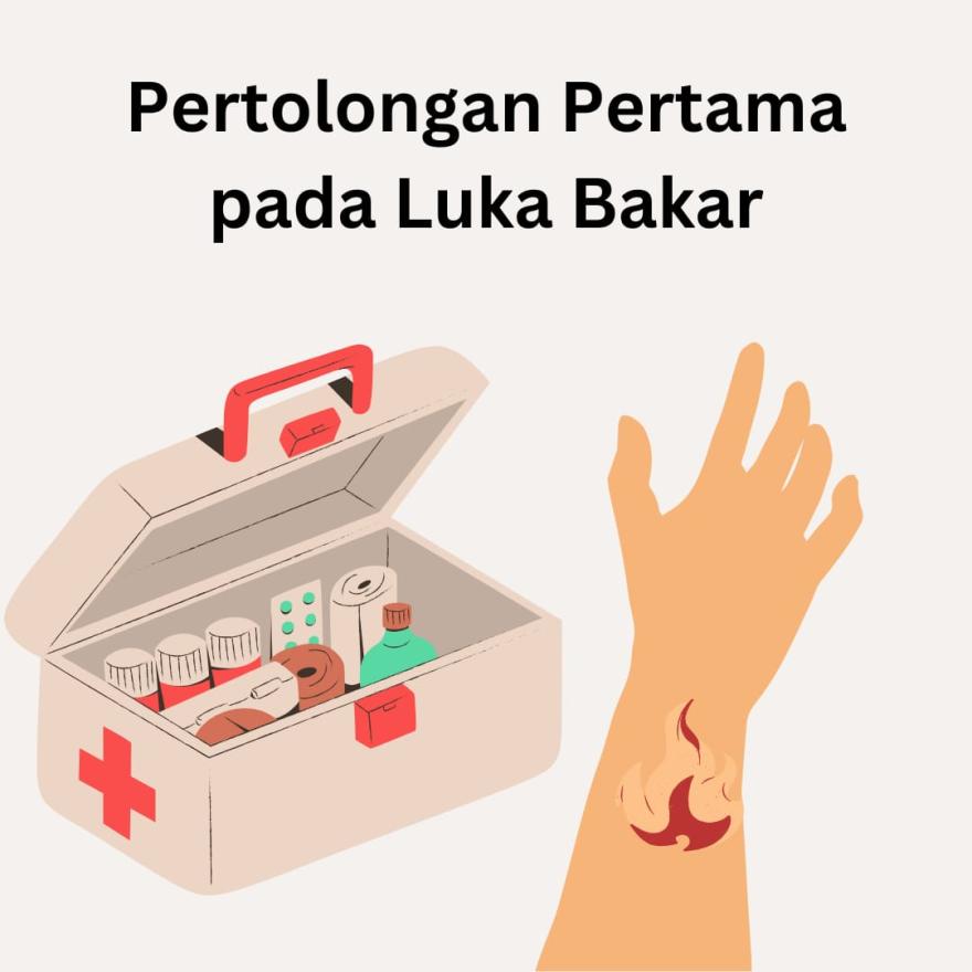 Cara Menangani Luka Bakar Ringan dengan Benar